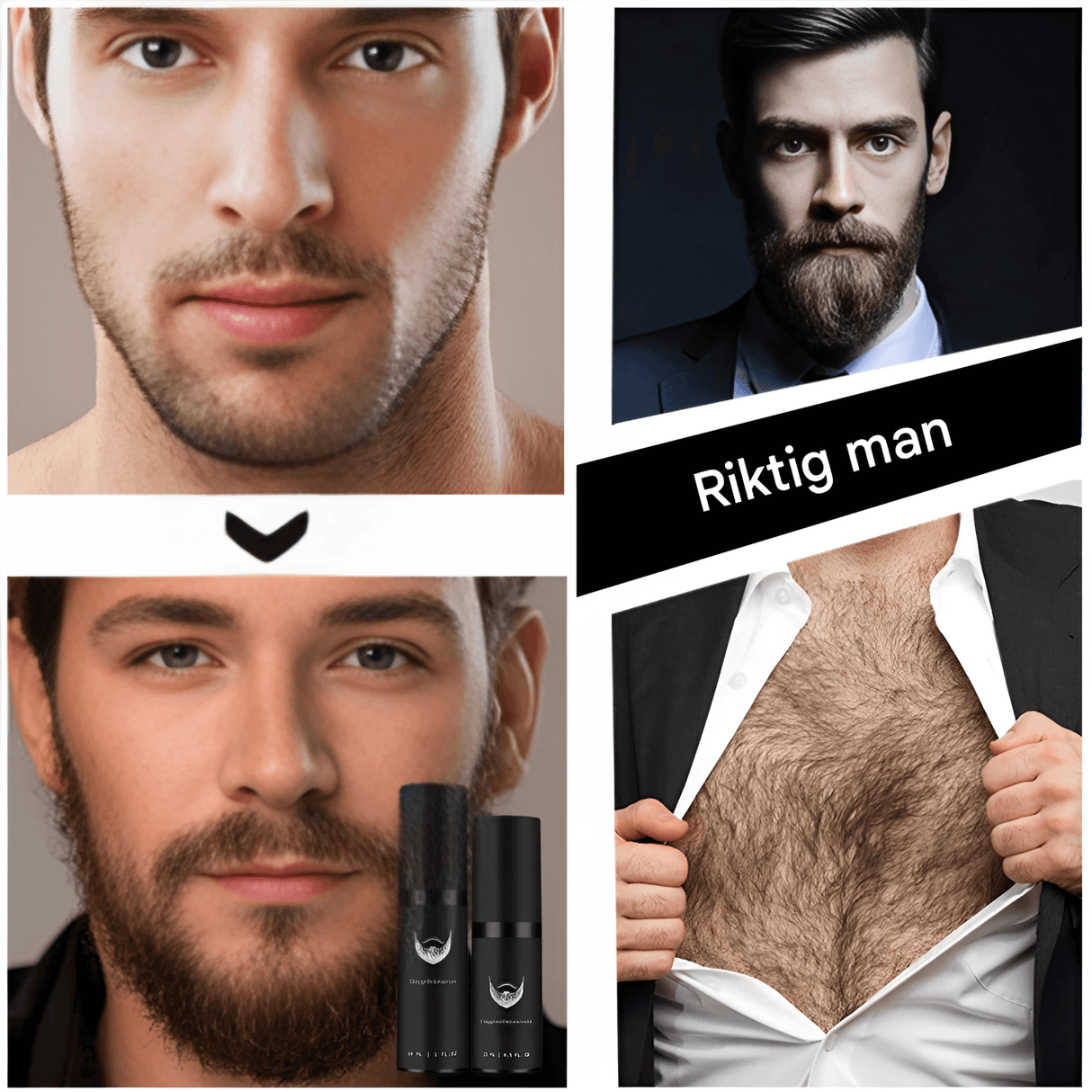 BeardForge – Partakasvupakkaus miehille, sisältää rullat, seerumin, desinfiointispray ja kampa