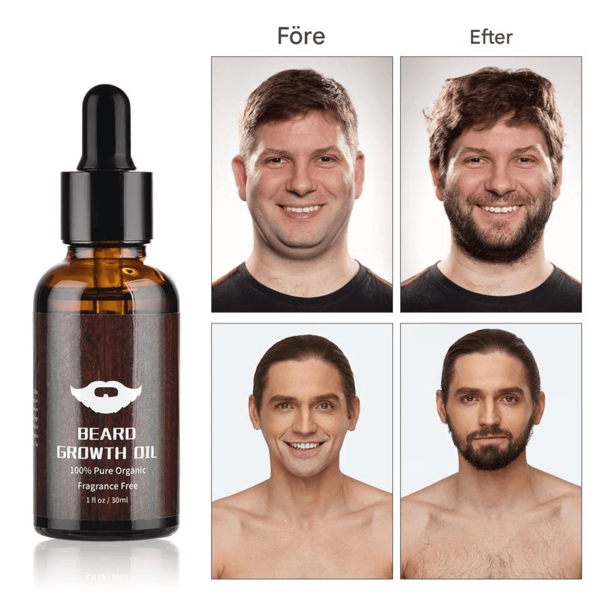 BeardPeak – Partahoitopakkaus, jossa öljy, balsami, mikroneulakela ja kampa hyvin hoidetulle partalle