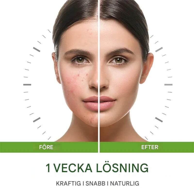 GrönRoa - Vegaaninen kasvovoide teepuulla | Rauhallisemmalle, tasapainoisemmalle iholle