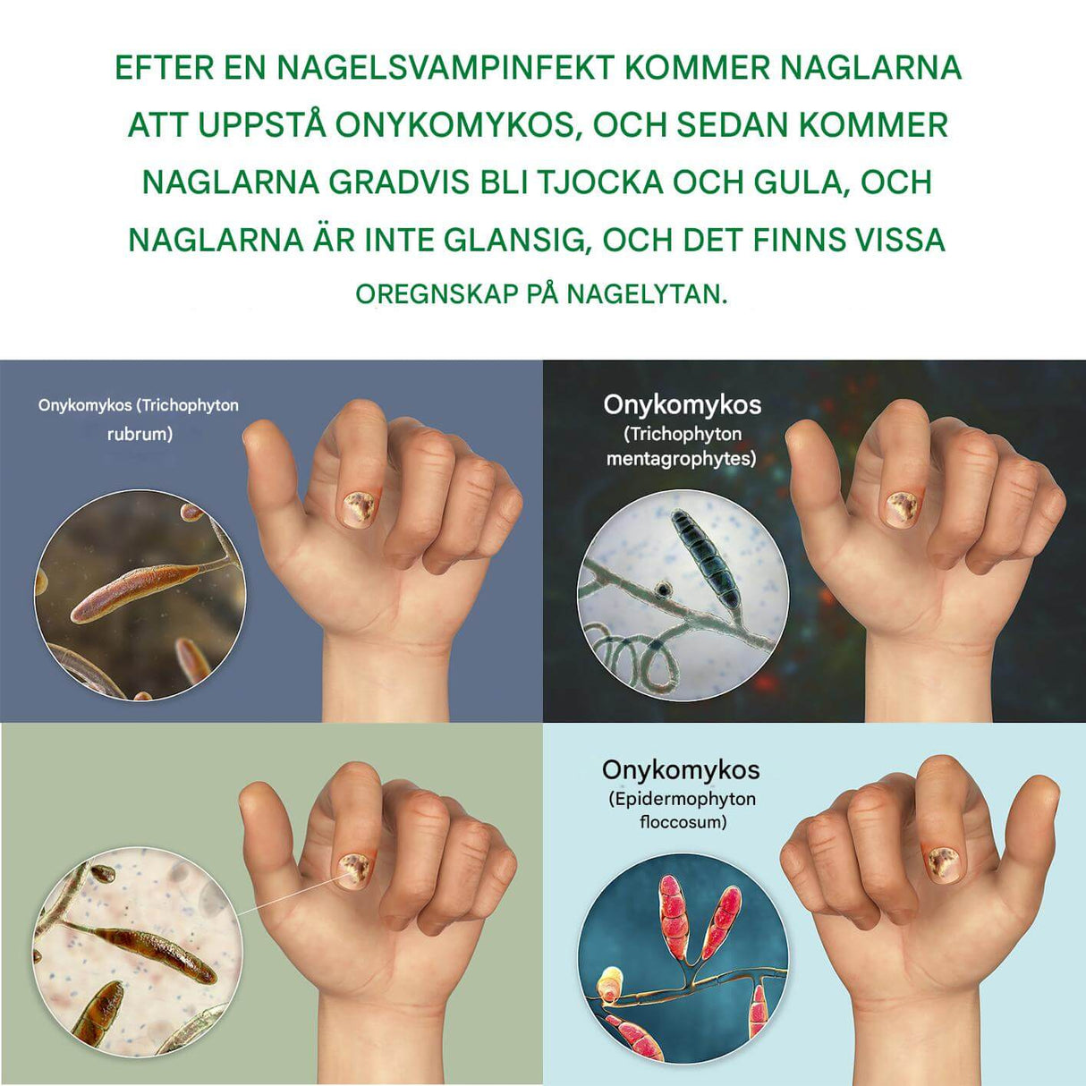 FungiClear - Anti-sieni kynsiseerumi | Tehokas kynsienhoito vahvempiin kynsiin.