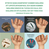 FungiClear - Anti-sieni kynsiseerumi | Tehokas kynsienhoito vahvempiin kynsiin.
