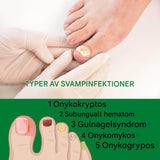 FungiClear - Anti-sieni kynsiseerumi | Tehokas kynsienhoito vahvempiin kynsiin.