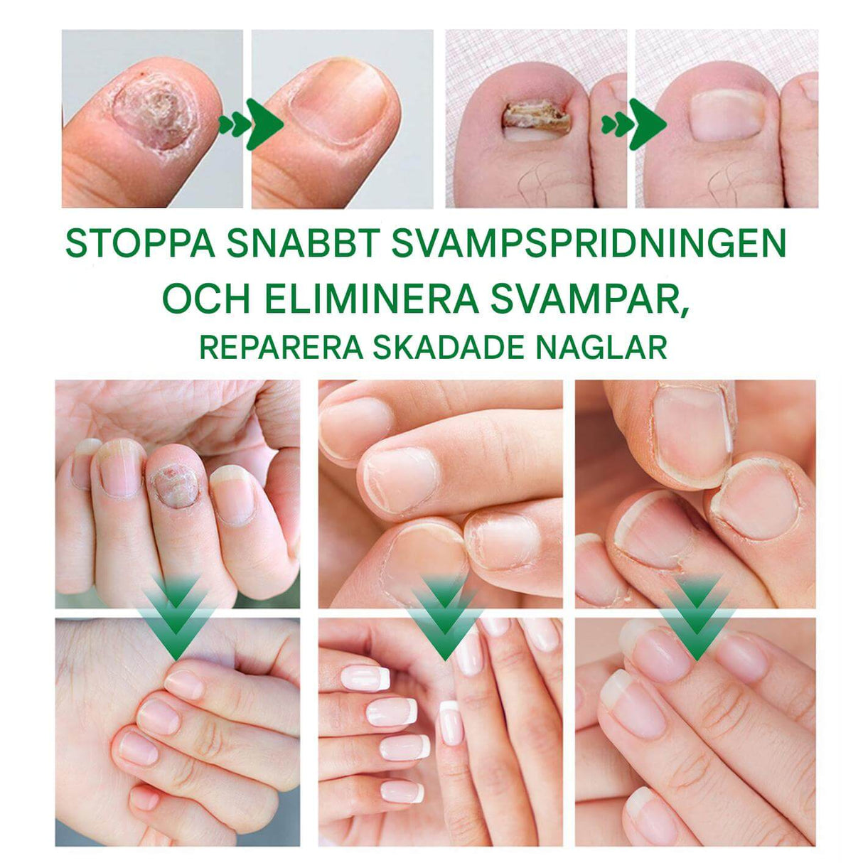 FungiClear - Anti-sieni kynsiseerumi | Tehokas kynsienhoito vahvempiin kynsiin.