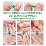FungiClear - Anti-sieni kynsiseerumi | Tehokas kynsienhoito vahvempiin kynsiin.